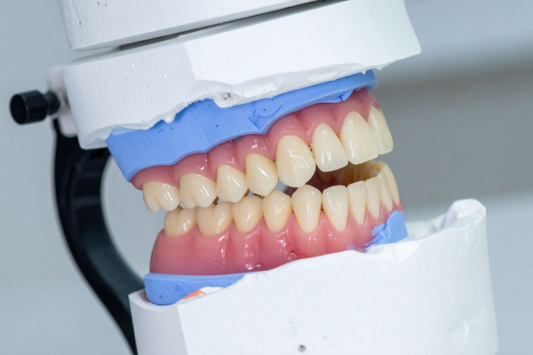 Dentures